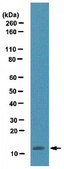 Anti-FSP1/S100A4 Antibody from rabbit