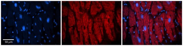 Anti-KIF23 antibody produced in rabbit affinity isolated antibody