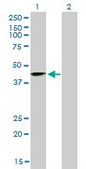 Monoclonal Anti-SIRT2 antibody produced in mouse clone 4B11, purified immunoglobulin, buffered aqueous solution