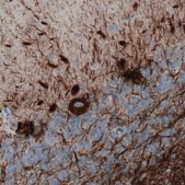 Monoclonal Anti-NEFM antibody produced in mouse Prestige Antibodies&#174; Powered by Atlas Antibodies, clone CL2688, purified immunoglobulin, buffered aqueous glycerol solution
