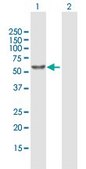 Anti-ALDH1A1 antibody produced in mouse purified immunoglobulin, buffered aqueous solution