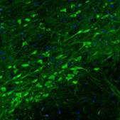 Monoclonal Anti-DDC antibody produced in mouse Prestige Antibodies&#174; Powered by Atlas Antibodies, clone CL2962, purified immunoglobulin, buffered aqueous glycerol solution