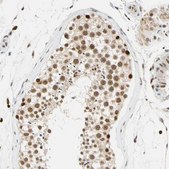 Anti-CDK7 antibody produced in rabbit Prestige Antibodies&#174; Powered by Atlas Antibodies, affinity isolated antibody, buffered aqueous glycerol solution