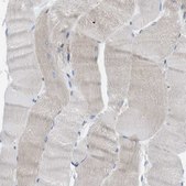 Anti-HACD3 antibody produced in rabbit Prestige Antibodies&#174; Powered by Atlas Antibodies, affinity isolated antibody, buffered aqueous glycerol solution