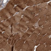 Anti-KCNJ2 antibody produced in rabbit Prestige Antibodies&#174; Powered by Atlas Antibodies, affinity isolated antibody, buffered aqueous glycerol solution