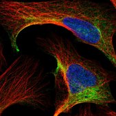 Anti-CCT8 antibody produced in rabbit Prestige Antibodies&#174; Powered by Atlas Antibodies, affinity isolated antibody, buffered aqueous glycerol solution