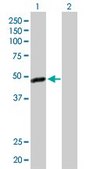 Anti-C17orf75 antibody produced in rabbit purified immunoglobulin, buffered aqueous solution