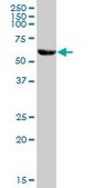Anti-CAT antibody produced in mouse purified immunoglobulin, buffered aqueous solution