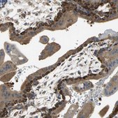 Anti-DIAPH2 antibody produced in rabbit Prestige Antibodies&#174; Powered by Atlas Antibodies, affinity isolated antibody, buffered aqueous glycerol solution