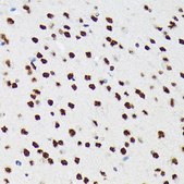 Anti-PTBP2 antibody produced in rabbit