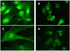 LentiBrite GFP-LC3 Lentiviral Biosensor