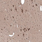 Anti-PMCH antibody produced in rabbit Prestige Antibodies&#174; Powered by Atlas Antibodies, affinity isolated antibody, buffered aqueous glycerol solution