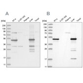Anti-HMGCS2 antibody produced in rabbit Prestige Antibodies&#174; Powered by Atlas Antibodies, affinity isolated antibody, buffered aqueous glycerol solution