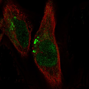 Monoclonal Anti-Adam10 Antibody Produced In Mouse Prestige Antibodies&#174; Powered by Atlas Antibodies, clone CL13814, affinity isolated antibody, buffered aqueous glycerol solution