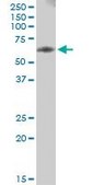 Anti-PHGDH antibody produced in mouse purified immunoglobulin, buffered aqueous solution