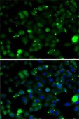 Anti-TAGLN2 antibody produced in rabbit