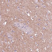 Anti-GPR176 antibody produced in rabbit Prestige Antibodies&#174; Powered by Atlas Antibodies, affinity isolated antibody, buffered aqueous glycerol solution