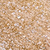 Anti-&#945;-Synuclein Antibody, clone 10Y4X3, Rabbit Monoclonal