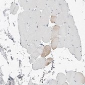 Anti-P4HA2 antibody produced in rabbit Prestige Antibodies&#174; Powered by Atlas Antibodies, affinity isolated antibody, buffered aqueous glycerol solution