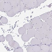 Anti-CYB5A antibody produced in rabbit Prestige Antibodies&#174; Powered by Atlas Antibodies, affinity isolated antibody, buffered aqueous glycerol solution
