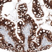 Monoclonal Anti-EPCAM antibody produced in mouse Prestige Antibodies&#174; Powered by Atlas Antibodies, clone CL6259, purified immunoglobulin, buffered aqueous glycerol solution