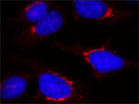 Anti-TGN46 antibody, Mouse monoclonal clone TGN46-8, purified from hybridoma cell culture