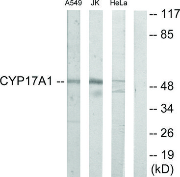 Anti-Cytochrome P450 17A1 antibody produced in rabbit affinity isolated antibody