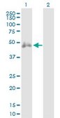 Anti-CD2 antibody produced in rabbit purified immunoglobulin, buffered aqueous solution