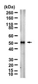 Anti-IRF-4 Antibody, clone 1E10 ZooMAb&#174; Rabbit Monoclonal recombinant, expressed in HEK 293 cells