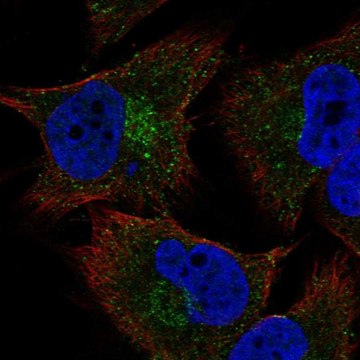 Anti-Col20A1 Antibody Produced In Rabbit Prestige Antibodies&#174; Powered by Atlas Antibodies, affinity isolated antibody, buffered aqueous glycerol solution
