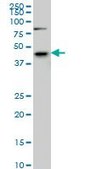 Monoclonal Anti-SGK2 antibody produced in mouse clone 7C7, purified immunoglobulin, buffered aqueous solution