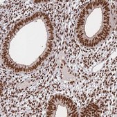 Anti-PRKDC antibody produced in rabbit Prestige Antibodies&#174; Powered by Atlas Antibodies, affinity isolated antibody, buffered aqueous glycerol solution