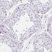 Anti-KCNN4 antibody produced in rabbit Prestige Antibodies&#174; Powered by Atlas Antibodies, affinity isolated antibody, buffered aqueous glycerol solution