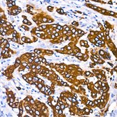 Anti-Cytokeratin 18 (KRT18) Antibody, clone 7B2N3, Rabbit Monoclonal