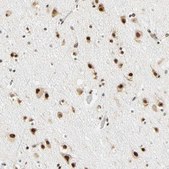 Anti-ZSCAN16 antibody produced in rabbit Prestige Antibodies&#174; Powered by Atlas Antibodies, affinity isolated antibody, buffered aqueous glycerol solution