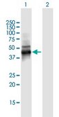 Anti-KRT19 antibody produced in mouse IgG fraction of antiserum, buffered aqueous solution