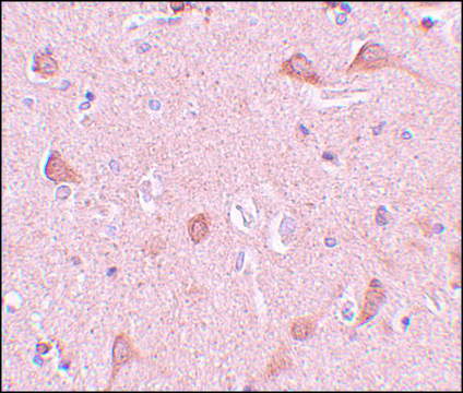 Anti-SIPA1L1 antibody produced in rabbit affinity isolated antibody, buffered aqueous solution