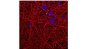 Anti-&#945;-Synuclein Antibody, clone 2F12 clone 2F12, from mouse