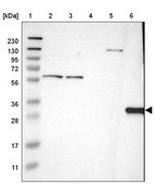Anti-HLA-DQB1 antibody produced in rabbit Prestige Antibodies&#174; Powered by Atlas Antibodies, affinity isolated antibody, buffered aqueous glycerol solution