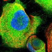 Anti-ATIC antibody produced in rabbit Prestige Antibodies&#174; Powered by Atlas Antibodies, affinity isolated antibody, buffered aqueous glycerol solution