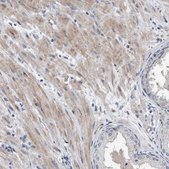 Anti-DST antibody produced in rabbit Prestige Antibodies&#174; Powered by Atlas Antibodies, affinity isolated antibody, buffered aqueous glycerol solution
