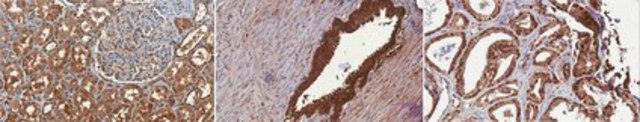 Anti-PSMD9 Antibody, clone 16C5.1 clone 16C5.1, from mouse