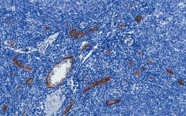 Anti-vWF Antibody, clone 1B21, ZooMAb&#174; Rabbit Monoclonal recombinant, expressed in HEK 293 cells