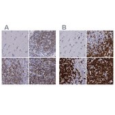 Anti-CD3E antibody produced in rabbit Prestige Antibodies&#174; Powered by Atlas Antibodies, affinity isolated antibody, buffered aqueous glycerol solution