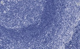 Anti-p-ZAP-70 (Tyr319) Antibody, clone 1B10 ZooMAb&#174; Rabbit Monoclonal recombinant, expressed in HEK 293 cells