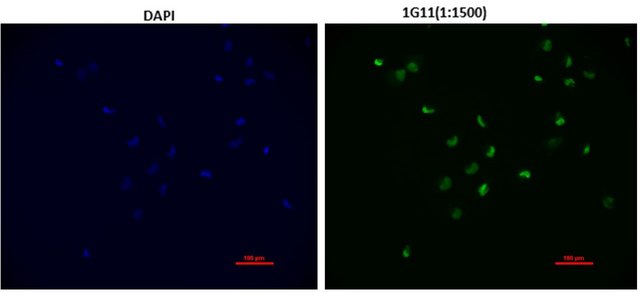 Anti-EZHIP Antibody, clone 1G11