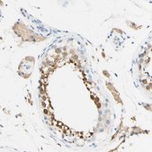 Anti-FGF4 antibody produced in rabbit Prestige Antibodies&#174; Powered by Atlas Antibodies, affinity isolated antibody, buffered aqueous glycerol solution