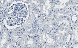 Anti-GLS Antibody, clone 1D16 ZooMAb&#174; Rabbit Monoclonal recombinant, expressed in HEK 293 cells