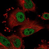 Anti-SNRNP70 antibody produced in rabbit Prestige Antibodies&#174; Powered by Atlas Antibodies, affinity isolated antibody, buffered aqueous glycerol solution