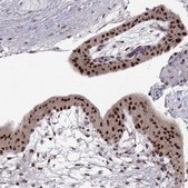 Monoclonal Anti-SNAI1 antibody produced in mouse Prestige Antibodies&#174; Powered by Atlas Antibodies, clone CL3700, purified immunoglobulin, buffered aqueous glycerol solution